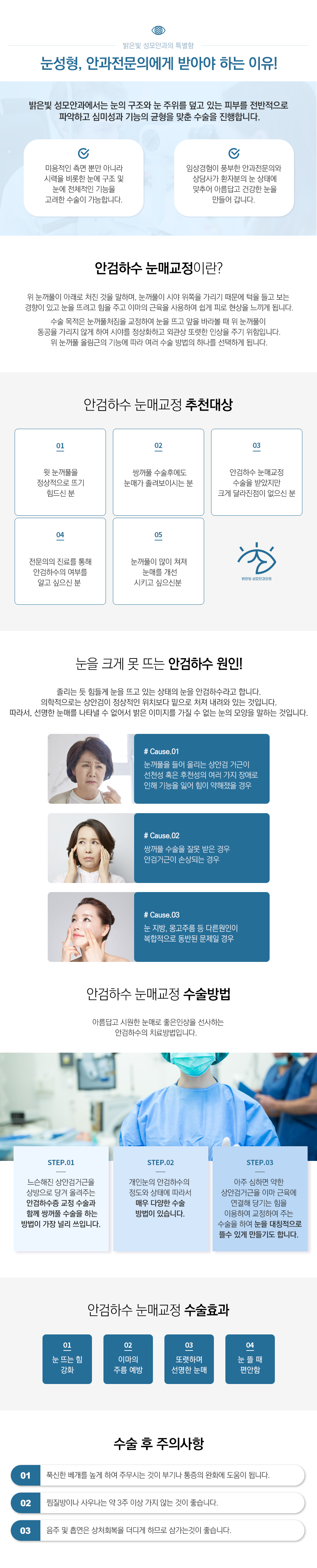 안검하수 눈매교정