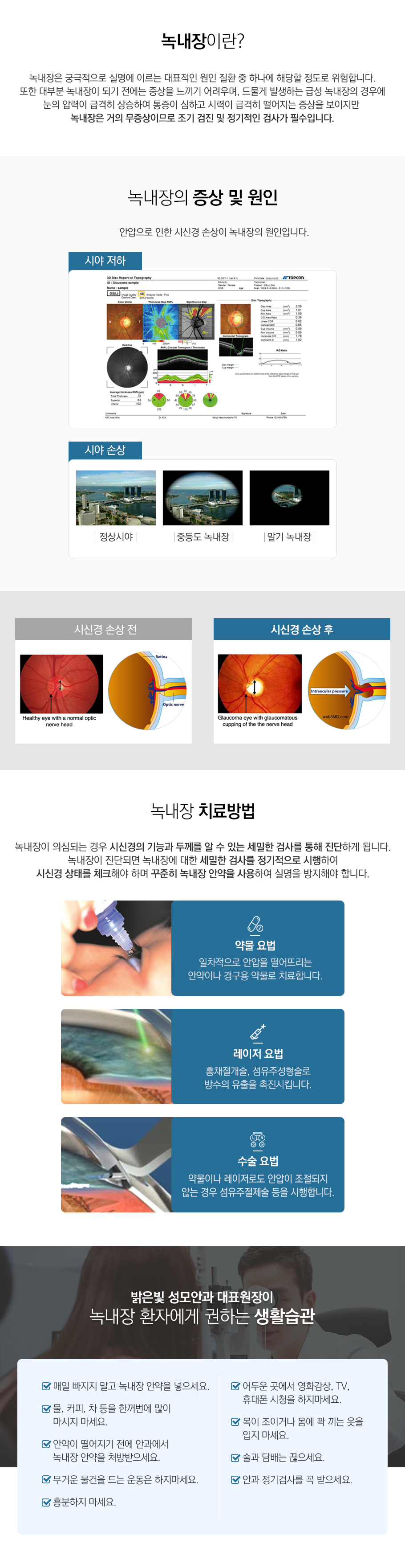 녹내장